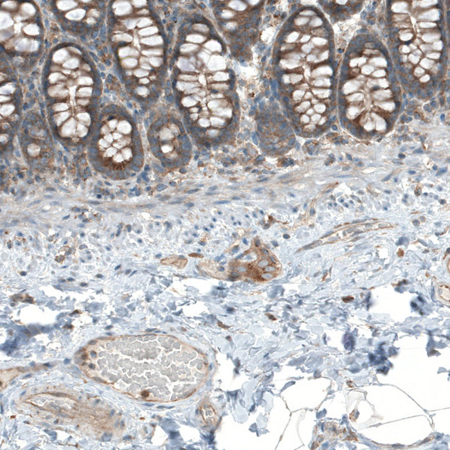 LZTR1 Antibody in Immunohistochemistry (Paraffin) (IHC (P))