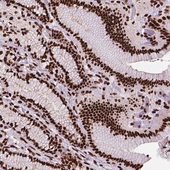SMIM5 Antibody in Immunohistochemistry (Paraffin) (IHC (P))