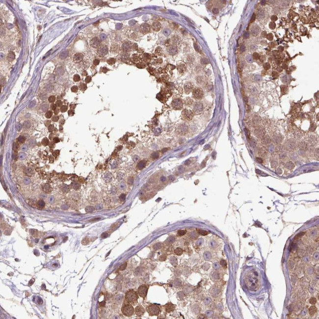 HSPBP1 Antibody in Immunohistochemistry (Paraffin) (IHC (P))