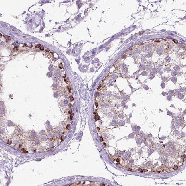 CTAG2 Antibody in Immunohistochemistry (Paraffin) (IHC (P))