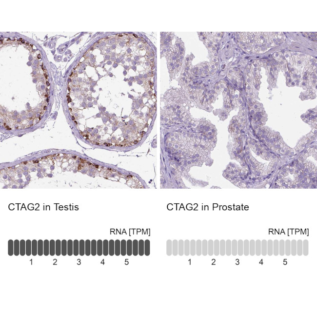 CTAG2 Antibody in Immunohistochemistry (IHC)