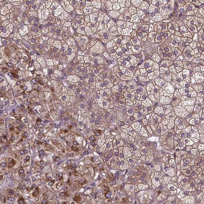 ZNF616 Antibody in Immunohistochemistry (Paraffin) (IHC (P))