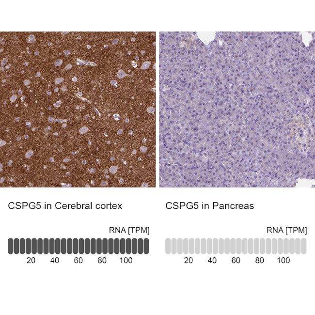 CSPG5 Antibody in Immunohistochemistry (IHC)