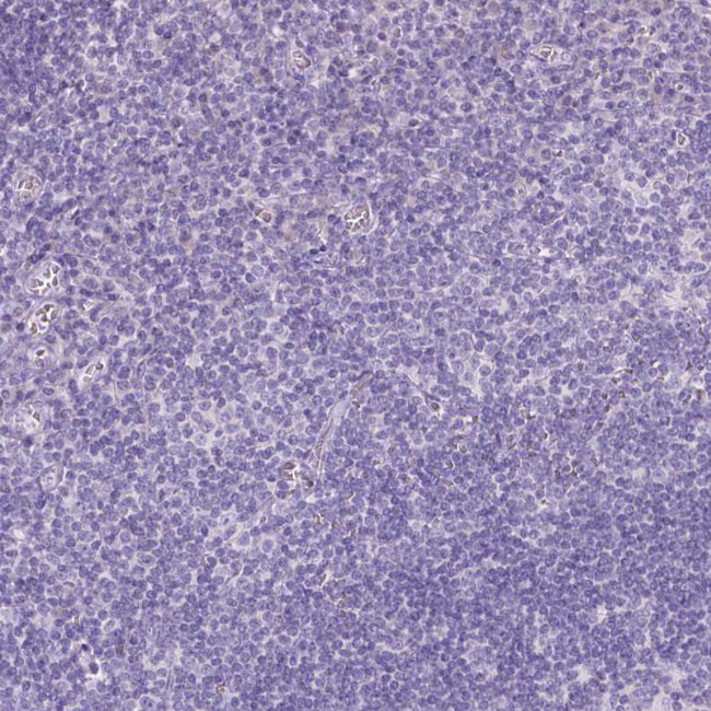 GAL3ST2 Antibody in Immunohistochemistry (Paraffin) (IHC (P))