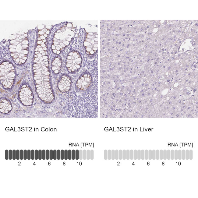 GAL3ST2 Antibody in Immunohistochemistry (IHC)
