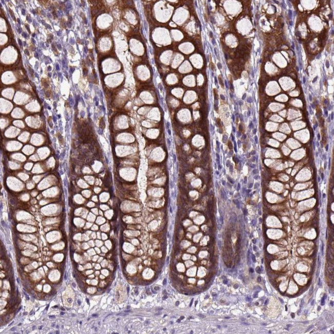 ARL1 Antibody in Immunohistochemistry (Paraffin) (IHC (P))