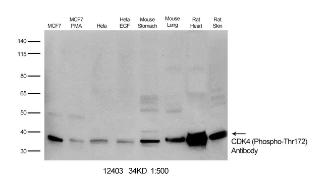 Phospho-CDK4 (Thr172) Antibody in Western Blot (WB)