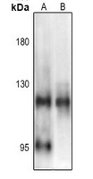 Phospho-NFkB p105 (Ser903) Antibody in Western Blot (WB)