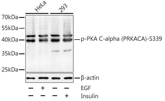Phospho-PKA alpha (Ser338) Antibody in Western Blot (WB)
