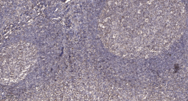 Phospho-PKC beta (Ser660) Antibody in Immunohistochemistry (Paraffin) (IHC (P))