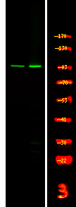 Phospho-FES (Tyr713) Antibody in Western Blot (WB)