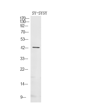 Phospho-GNAZ (Ser16) Antibody in Western Blot (WB)