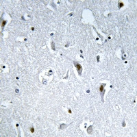 Phospho-HMGN2 (Ser29) Antibody in Immunohistochemistry (Paraffin) (IHC (P))