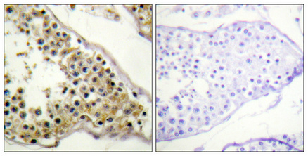 Phospho-ITK (Tyr512) Antibody in Immunohistochemistry (Paraffin) (IHC (P))