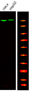 Phospho-TOP2A (Ser1213) Antibody in Western Blot (WB)