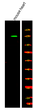 Phospho-KIF1C (Ser1092) Antibody in Western Blot (WB)