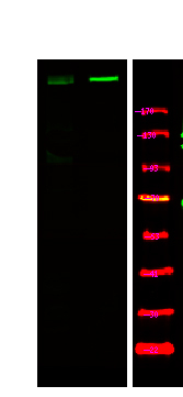 Phospho-ATM (Ser1893) Antibody in Western Blot (WB)