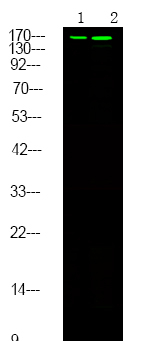 Phospho-c-Met (Ser985) Antibody in Western Blot (WB)