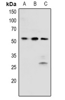 Phospho-BRK (Tyr342) Antibody in Western Blot (WB)