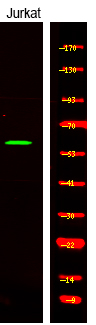 Phospho-CAMKK alpha/beta (Ser458, Ser495) Antibody in Western Blot (WB)