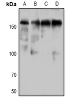 Phospho-DAPK1 (Ser736) Antibody in Western Blot (WB)