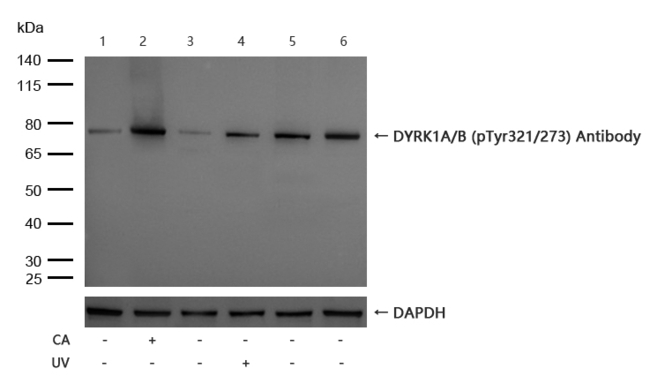 Phospho-DYRK1A/DYRK1B (Tyr321, Tyr273) Antibody in Western Blot (WB)