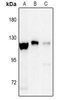 Phospho-EphA8 (Tyr838) Antibody in Western Blot (WB)