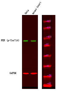 Phospho-FER (Tyr714) Antibody in Western Blot (WB)
