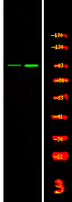 Phospho-FGFR4 (Tyr754) Antibody in Western Blot (WB)