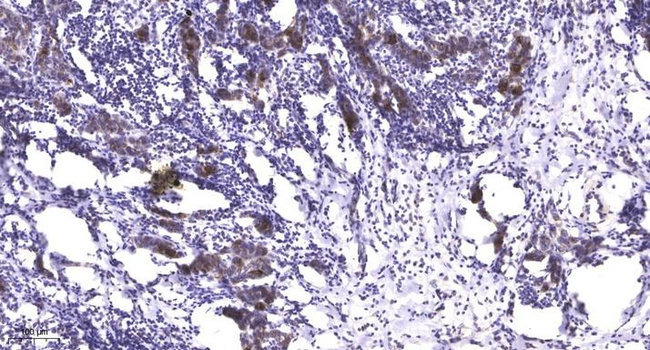 Phospho-LATS1/LATS2 (Ser909, Ser872) Antibody in Immunohistochemistry (Paraffin) (IHC (P))