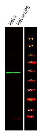 Phospho-MST3 (Thr18) Antibody in Western Blot (WB)