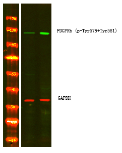 Phospho-PDGFRB (Tyr579, Tyr581) Antibody in Western Blot (WB)