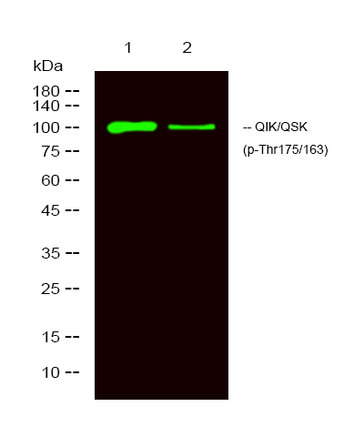 Phospho-SIK2 (Thr175, Thr221) Antibody in Western Blot (WB)
