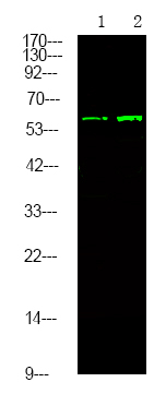 Phospho-TGFBR2 (Tyr284) Antibody in Western Blot (WB)