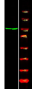 Phospho-Androgen Receptor (Ser81) Antibody in Western Blot (WB)