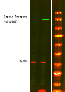 Phospho-Leptin Receptor (Tyr986) Antibody in Western Blot (WB)