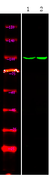 Phospho-Androgen Receptor (Tyr534) Antibody in Western Blot (WB)