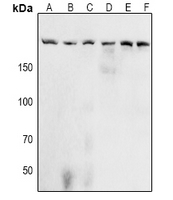 Phospho-Acinus (Ser1180) Antibody in Western Blot (WB)