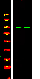 Phospho-BCL6 (Ser343) Antibody in Western Blot (WB)