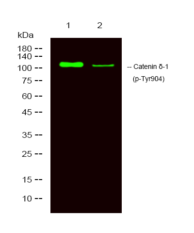 Phospho-delta Catenin (Tyr904) Antibody in Western Blot (WB)