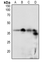 Phospho-RCAN1 (Ser108) Antibody in Western Blot (WB)