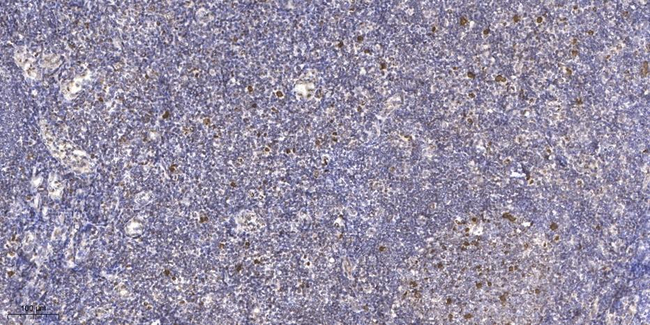Phospho-JDP2 (Thr148) Antibody in Immunohistochemistry (Paraffin) (IHC (P))