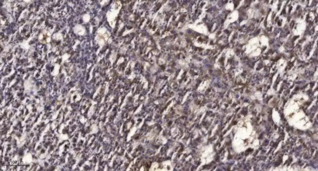 Phospho-RAD50 (Ser635) Antibody in Immunohistochemistry (Paraffin) (IHC (P))