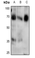 Phospho-SMAD4 (Thr276) Antibody in Western Blot (WB)