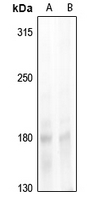 Phospho-SRC1 (Thr1179) Antibody in Western Blot (WB)