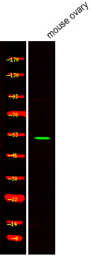 Phospho-NR5A1 (Ser203) Antibody in Western Blot (WB)