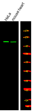 Phospho-USP28 (Ser67) Antibody in Western Blot (WB)