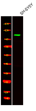 Phospho-ACK1 (Tyr857, Tyr858) Antibody in Western Blot (WB)