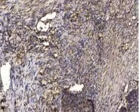 Phospho-DOK2 (Tyr345) Antibody in Immunohistochemistry (Paraffin) (IHC (P))