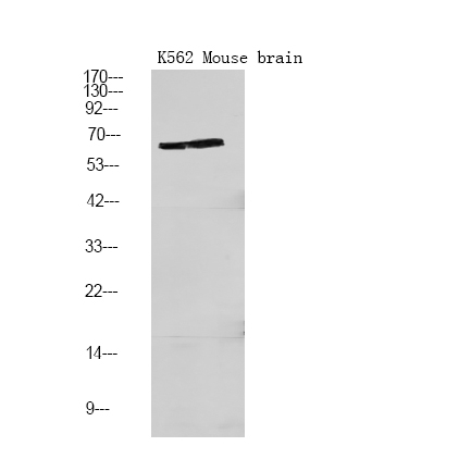 Phospho-PFKFB2 (Ser466) Antibody in Western Blot (WB)